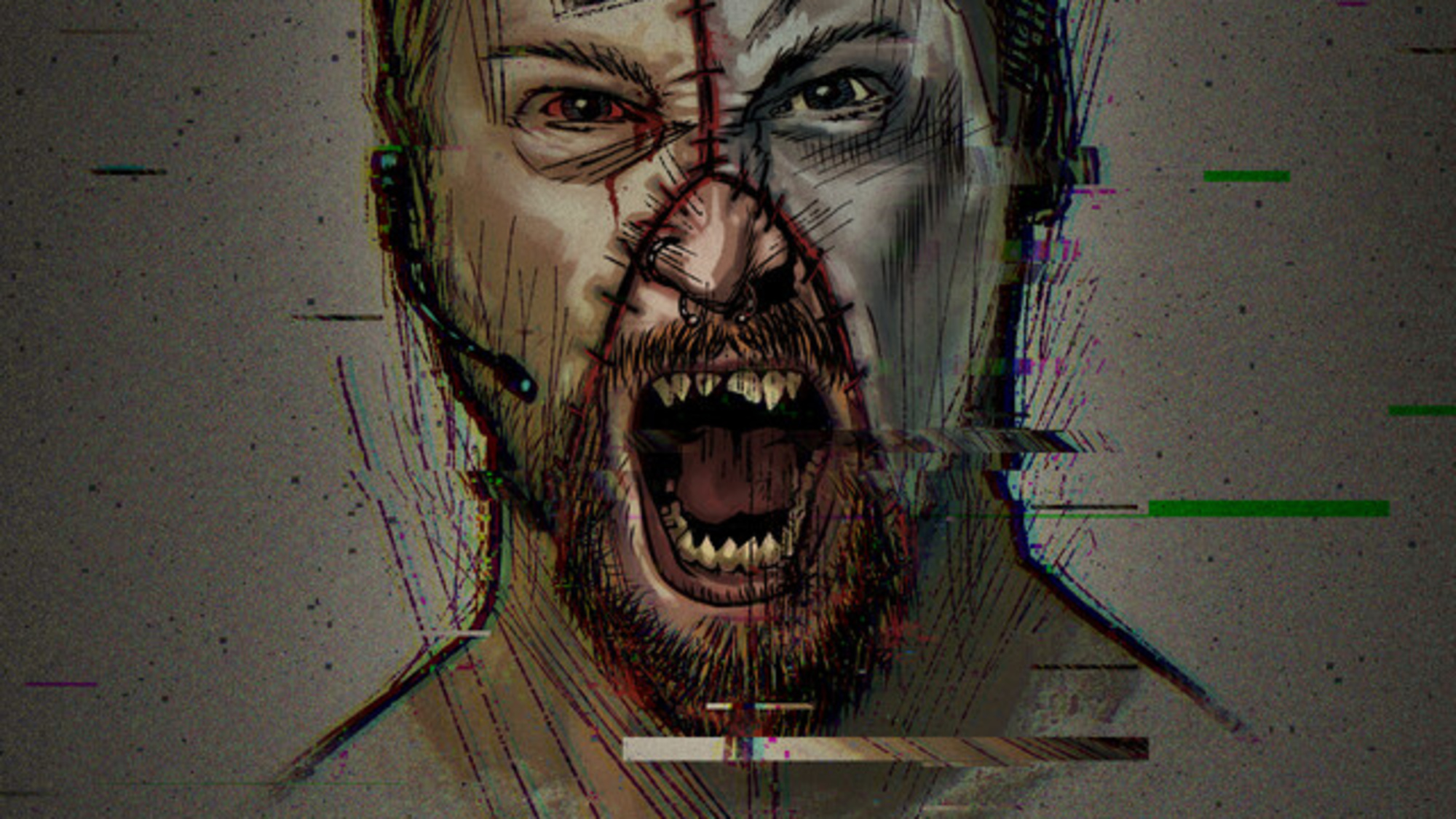 Stitches