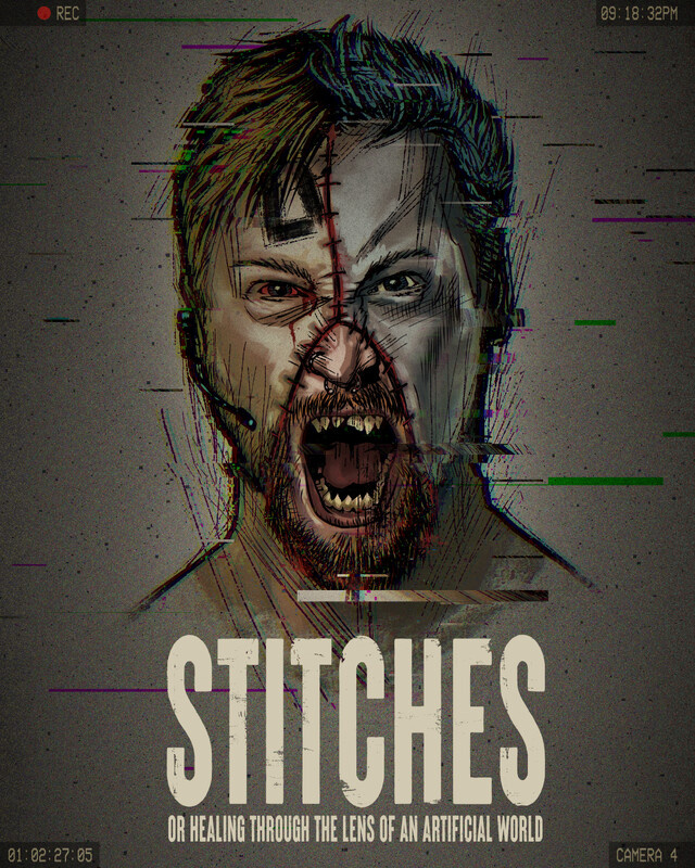 Stitches